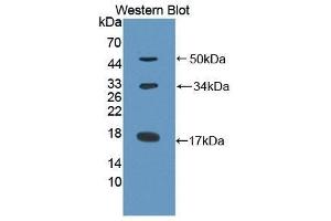 Western Blotting (WB) image for anti-Collagen, Type X (COL10) antibody (Biotin) (ABIN1175583) (COL10 抗体  (Biotin))
