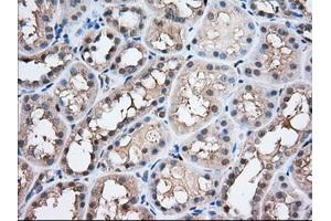 Immunohistochemical staining of paraffin-embedded Human prostate tissue using anti-PFN1 mouse monoclonal antibody. (PFN1 抗体)