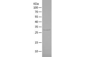 Western Blotting (WB) image for Solute Carrier Family 30 (Zinc Transporter), Member 8 (SLC30A8) (AA 1-79) protein (His-IF2DI Tag) (ABIN7282511) (SLC30A8 Protein (AA 1-79) (His-IF2DI Tag))