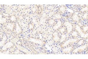Immunohistochemistry (IHC) image for anti-Carboxypeptidase A1 (Pancreatic) (CPA1) (AA 205-419) antibody (ABIN7435979)