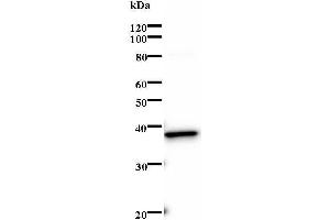 Western Blotting (WB) image for anti-SRY (Sex Determining Region Y)-Box 4 (SOX4) antibody (ABIN932199) (SOX4 抗体)