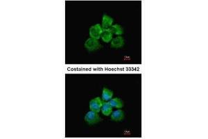 ICC/IF Image Immunofluorescence analysis of methanol-fixed A431, using ARHGEF18, antibody at 1:200 dilution. (ARHGEF18 抗体  (Center))