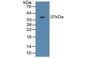 Detection of FCN1 in Rat Serum using Polyclonal Antibody to Ficolin 1 (FCN1) (FCN1 抗体  (AA 25-279))