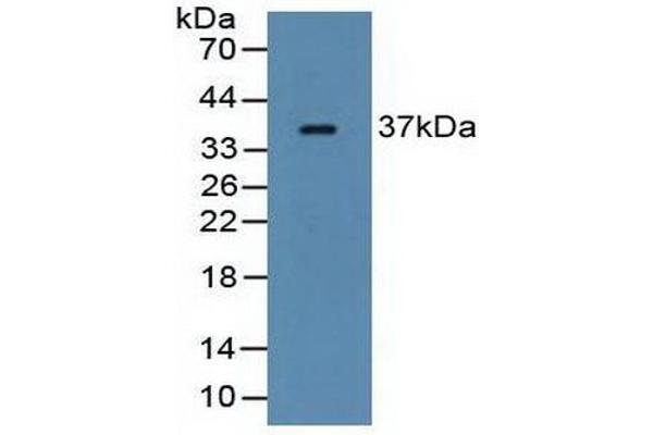 FCN1 抗体  (AA 25-279)