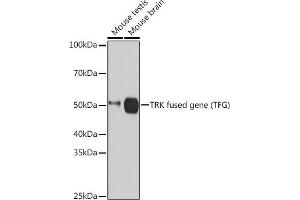 Western blot analysis of extracts of various cell lines, using TRK fused gene (TFG) (TFG) Rabbit mAb (ABIN1512690, ABIN3022090, ABIN3022091 and ABIN7101442) at 1:3000 dilution. (TFG 抗体)