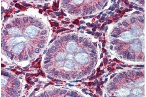 Colon, Human: Formalin-Fixed, Paraffin-Embedded (FFPE) (IGFBP4 抗体  (AA 180-229))