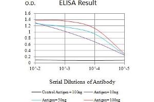 Black line: Control Antigen (100 ng),Purple line: Antigen (10 ng), Blue line: Antigen (50 ng), Red line:Antigen (100 ng) (L1CAM 抗体  (AA 20-197))