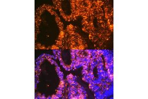 Immunofluorescence analysis of human ovary using Lin28 Rabbit mAb (ABIN7268266) at dilution of 1:100 (40x lens). (LIN28A 抗体)