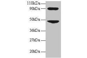 Western blot All lanes: CCL7 antibody at 2 μg/mL + 293T whole cell lysate Secondary Goat polyclonal to rabbit IgG at 1/15000 dilution Predicted band size: 12 kDa Observed band size: 48, 90 kDa (CCL7 抗体  (AA 24-99))