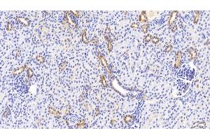 Detection of NOG in Human Kidney Tissue using Polyclonal Antibody to Noggin (NOG) (NOG 抗体  (AA 28-232))