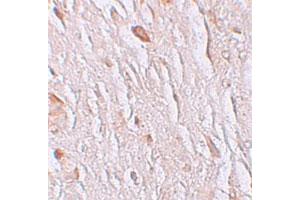 Immunohistochemical staining of human brain cells with SLC39A7 polyclonal antibody  at 2. (SLC39A7 抗体  (N-Term))