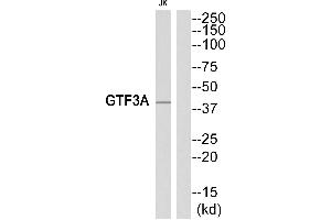 Western blot analysis of extracts from Jurkat cells, using GTF3A antibody. (GTF3A 抗体  (Internal Region))