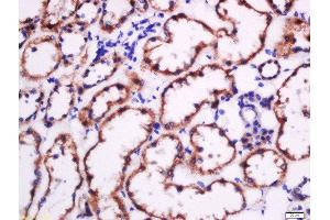 Paraformaldehyde-fixed, paraffin embedded human kidney tissue, Antigen retrieval by boiling in sodium citrate buffer(pH6) for 15min, Block endogenous peroxidase by 3% hydrogen peroxide for 30 minutes, Blocking buffer (normal goat serum) at 37°C for 20min, Antibody incubation with Rabbit Anti-Fibronectin Polyclonal Antibody, Unconjugated  at 1:500 overnight at 4°C, followed by a conjugated secondary and DAB staining (Fibronectin 抗体  (AA 1201-1300))