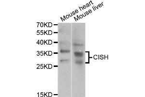 Western blot analysis of extracts of various cell lines, using CISH antibody (ABIN5973711) at 1/1000 dilution. (CISH 抗体)