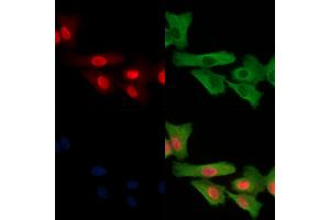 Phospho-Calsenilin/KCNIP3 (Ser63) Antibody staining A549 cells(H2O2 treatment) by IF/ICC. (DREAM 抗体  (pSer63))