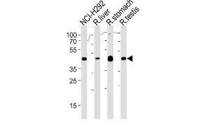 Western Blotting (WB) image for anti-Polycomb Group Ring Finger 6 (PCGF6) antibody (ABIN3000530) (PCGF6 抗体)