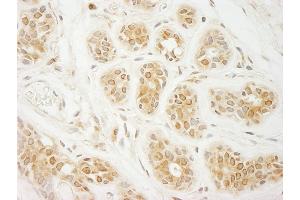 Immunohistochemistry (IHC) image for anti-Eukaryotic Translation Initiation Factor 2A, 65kDa (EIF2A) (AA 525-575) antibody (ABIN7453862)