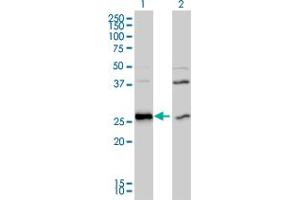 Western Blot analysis of DNAJB6 expression in transfected 293T cell line by DNAJB6 monoclonal antibody (M01), clone 2C11-C1. (DNAJB6 抗体  (AA 1-241))