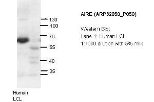 Image no. 2 for anti-Autoimmune Regulator (AIRE) (N-Term) antibody (ABIN2779777) (AIRE 抗体  (N-Term))