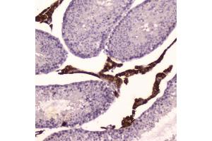 IHC testing of FFPE mouse testis tissue with Cyp17a1 antibody at 2ug/ml. (CYP17A1 抗体  (AA 80-363))