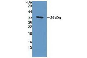 Detection of Recombinant MAPRE1, Human using Polyclonal Antibody to Microtubule Associated Protein RP/EB Family, Member 1 (MAPRE1) (MAPRE1 抗体  (AA 2-268))