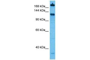Host:  Rabbit  Target Name:  CGN  Sample Tissue:  Human THP-1 Whole Cell lysates  Antibody Dilution:  1ug/ml (Cingulin 抗体  (C-Term))