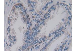 Used in DAB staining on fromalin fixed paraffin-embedded Liver tissue (PCSK9 抗体  (AA 156-461))