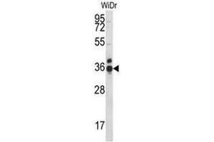 CCDC90B Antibody (Center) western blot analysis in WiDr cell line lysates (35µg/lane). (CCDC90B 抗体  (Middle Region))