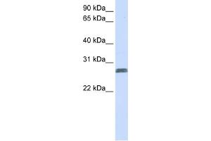WB Suggested Anti-TMEM51 Antibody Titration:  0. (TMEM51 抗体  (N-Term))