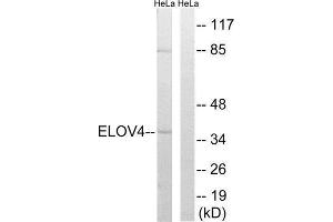 Western Blotting (WB) image for anti-ELOVL Fatty Acid Elongase 4 (ELOVL4) (Internal Region) antibody (ABIN1851294) (ELOVL4 抗体  (Internal Region))