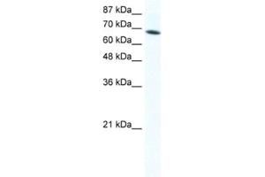 Western Blotting (WB) image for anti-DEAD (Asp-Glu-Ala-Asp) Box Polypeptide 1 (DDX1) antibody (ABIN2461580) (DDX1 抗体)