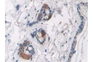 Immunohistochemistry (IHC) image for anti-Advanced Glycosylation End Product-Specific Receptor (AGER) (AA 1-237) antibody (ABIN7441463)