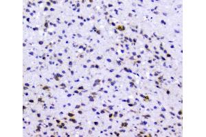 IHC analysis of Rad51 using anti-Rad51 antibody (ABIN6719396).