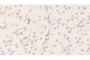 Detection of CYPA in Rat Cerebrum Tissue using Polyclonal Antibody to Cyclophilin A (CYPA) (PPIA 抗体  (AA 2-164))