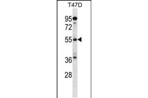 Western blot analysis in T47D cell line lysates (35ug/lane). (ARFGAP3 抗体  (C-Term))