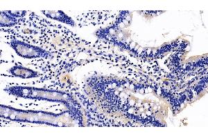 Detection of MGAM in Porcine Small intestine Tissue using Polyclonal Antibody to Maltase-glucoamylase (MGAM)