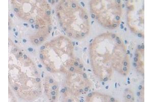 Immunohistochemistry (IHC) image for anti-Profilin 2 (PFN2) (AA 5-140) antibody (ABIN7437743)