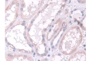 Immunohistochemistry (IHC) image for anti-Thiopurine S-Methyltransferase (TPMT) (AA 26-227) antibody (ABIN7435148)