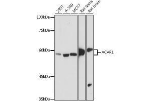 Western blot analysis of extracts of various cell lines, using  antibody (ABIN7265415) at 1:1000 dilution. (ACVR1 抗体)