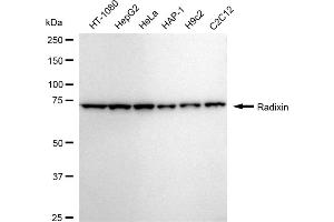Western blotting analysis using Radixin antibody (ABIN7800123). (Recombinant Radixin 抗体)