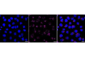 Immunocytochemical staining of HT- cells with Early endosome antigen 1 antibody (ABIN7798421), 1:1,000). (Recombinant EEA1 抗体)