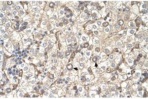 Immunohistochemistry (IHC) image for anti-ST3 beta-Galactoside alpha-2,3-Sialyltransferase 4 (ST3GAL4) (Middle Region) antibody (ABIN2782704)