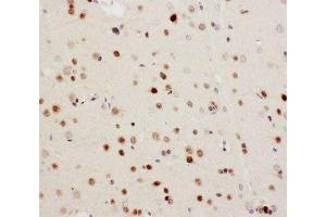 IHC-P: MEKK3 antibody testing of rat brain tissue (MAP3K3 抗体  (N-Term))