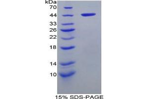 SDS-PAGE analysis of Rat aHSP Protein. (aHSP 蛋白)