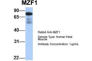 Host: Rabbit Target Name: MZF1 Sample Type: Human Fetal Muscle Antibody Dilution: 1. (MZF1 抗体  (N-Term))