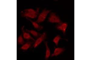 ABIN6275958 staining HuvEc by IF/ICC. (GPR151 抗体  (C-Term))