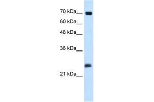 Western Blotting (WB) image for anti-SERTA Domain Containing 1 (SERTAD1) antibody (ABIN2460914) (SERTAD1 抗体)