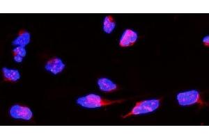 IF analysis of CD168/HMMR using anti-CD168/HMMR antibody (ABIN7601892).