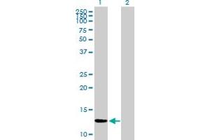 Western Blot analysis of ZNF343 expression in transfected 293T cell line by ZNF343 MaxPab polyclonal antibody. (ZNF343 抗体  (AA 1-118))