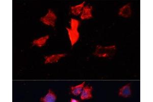 Immunofluorescence analysis of HeLa cells using CALM3 Polyclonal Antibody at dilution of 1:100. (Calmodulin 3 抗体)